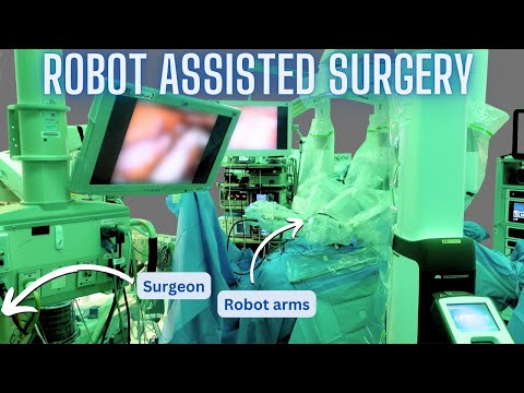 How Robotic Surgery Works and Why It Is Growing Rapidly